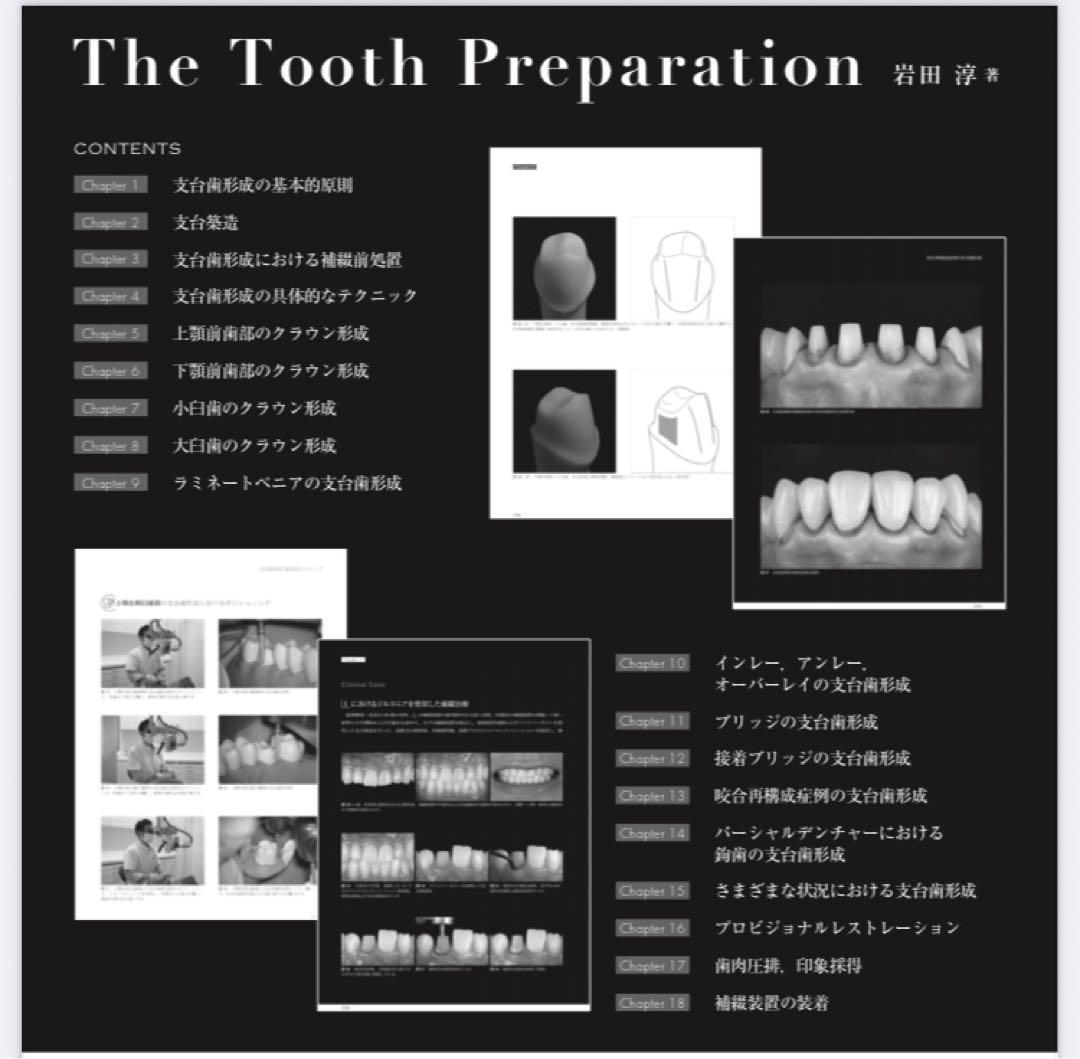 The Tooth Preparation 岩田淳