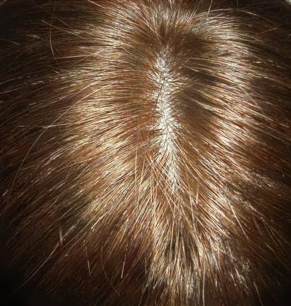 人毛　ウィッグ　人工皮膚付き　ブラウン　スーパーロング　Sサイズ