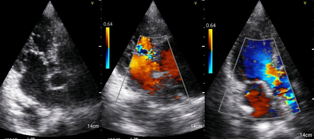 GE Vscan Extend 医療用モニタリング機器