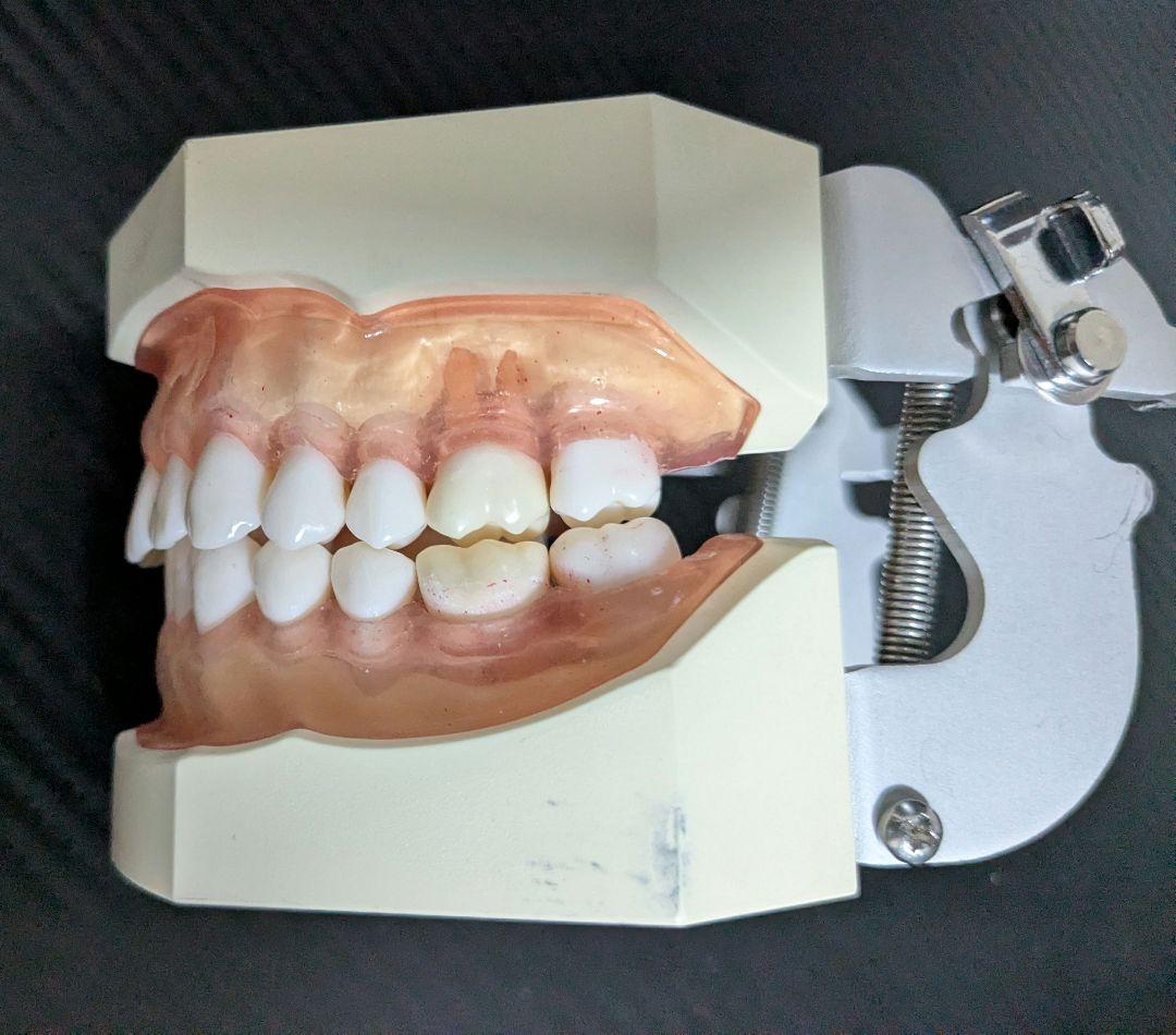 ニッシン　顎模型 複製歯牙着脱模型　実習用 舌、スタンド付き