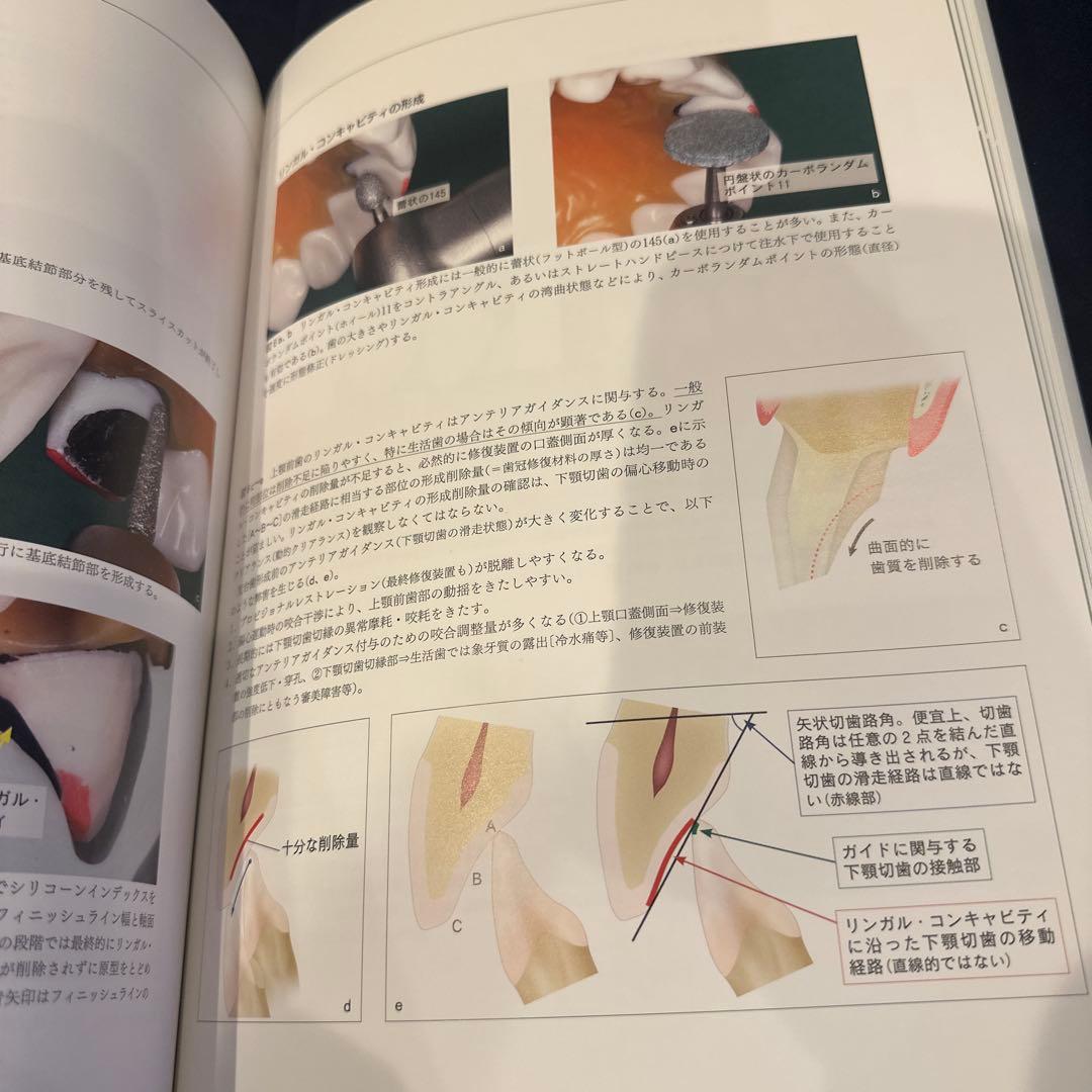 必ず上達 デジタル時代の歯冠修復　最終値下げ