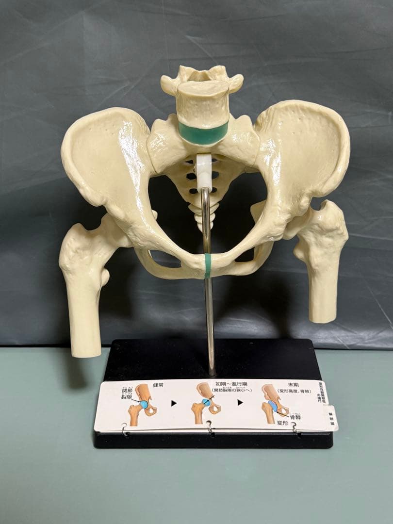 Voltaren 骨盤模型 大腿骨付き腰椎 脊髄 骨格模型　骨模型 人体模型