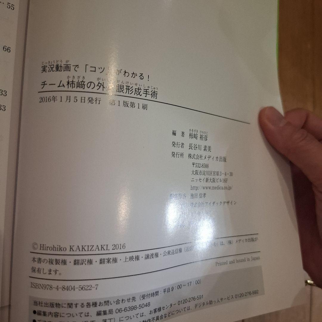 チーム柿﨑の外来眼形成手術 実況動画で「コツ」がわかる!