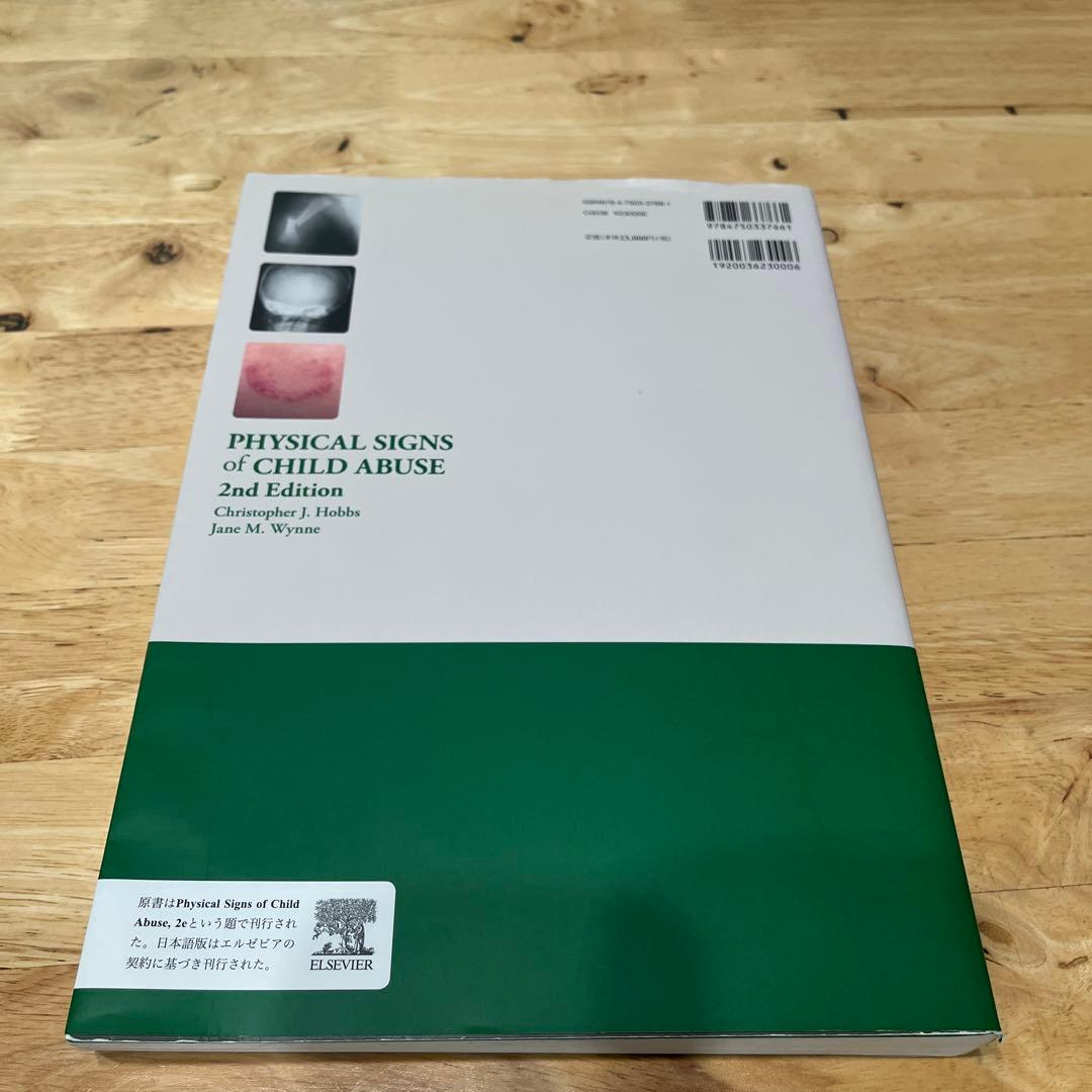 子ども虐待の身体所見