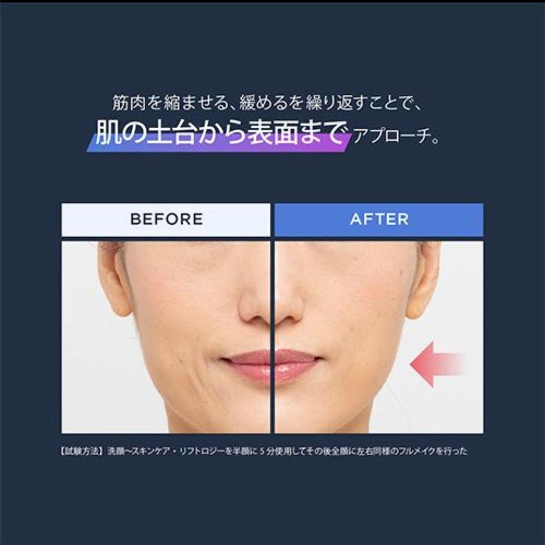 美品 YA-MAN ヤーマン リフトロジー YJFD1N ゴールド