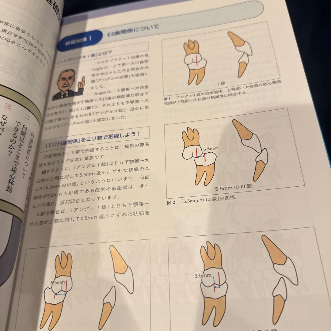図解!矯正治療が面白いほどわかる本 : 基礎知識-セファロ分析-診断-治療の実…