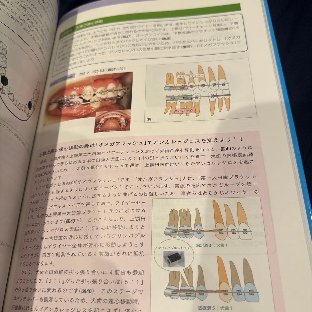 図解!矯正治療が面白いほどわかる本 : 基礎知識-セファロ分析-診断-治療の実…