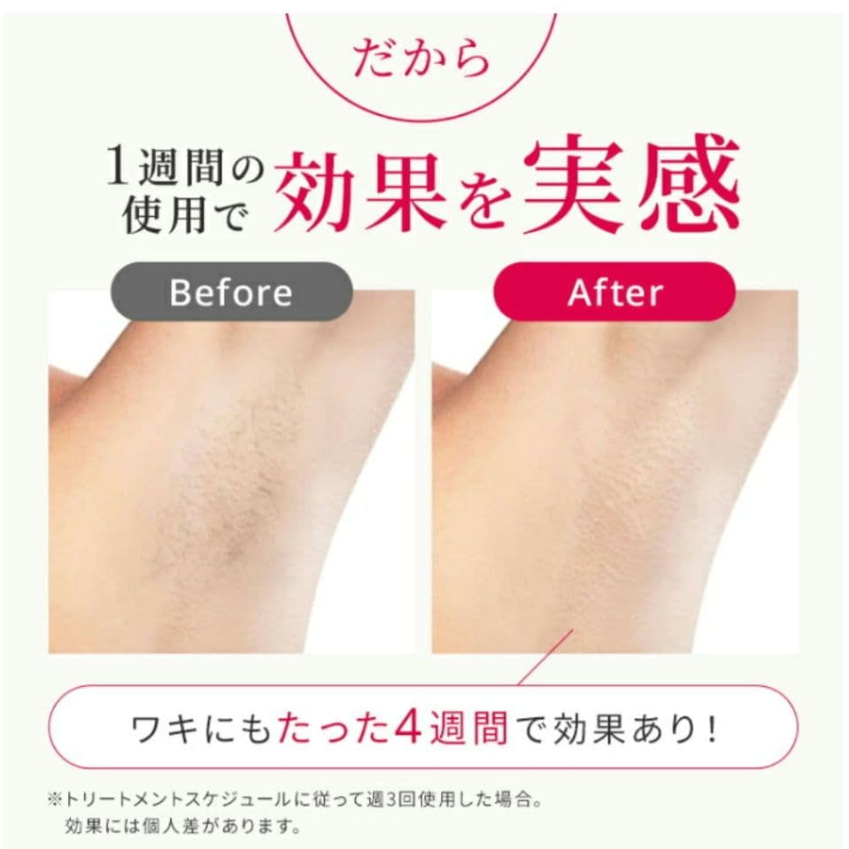 【未使用】Ulike Air10 IPL 光脱毛機