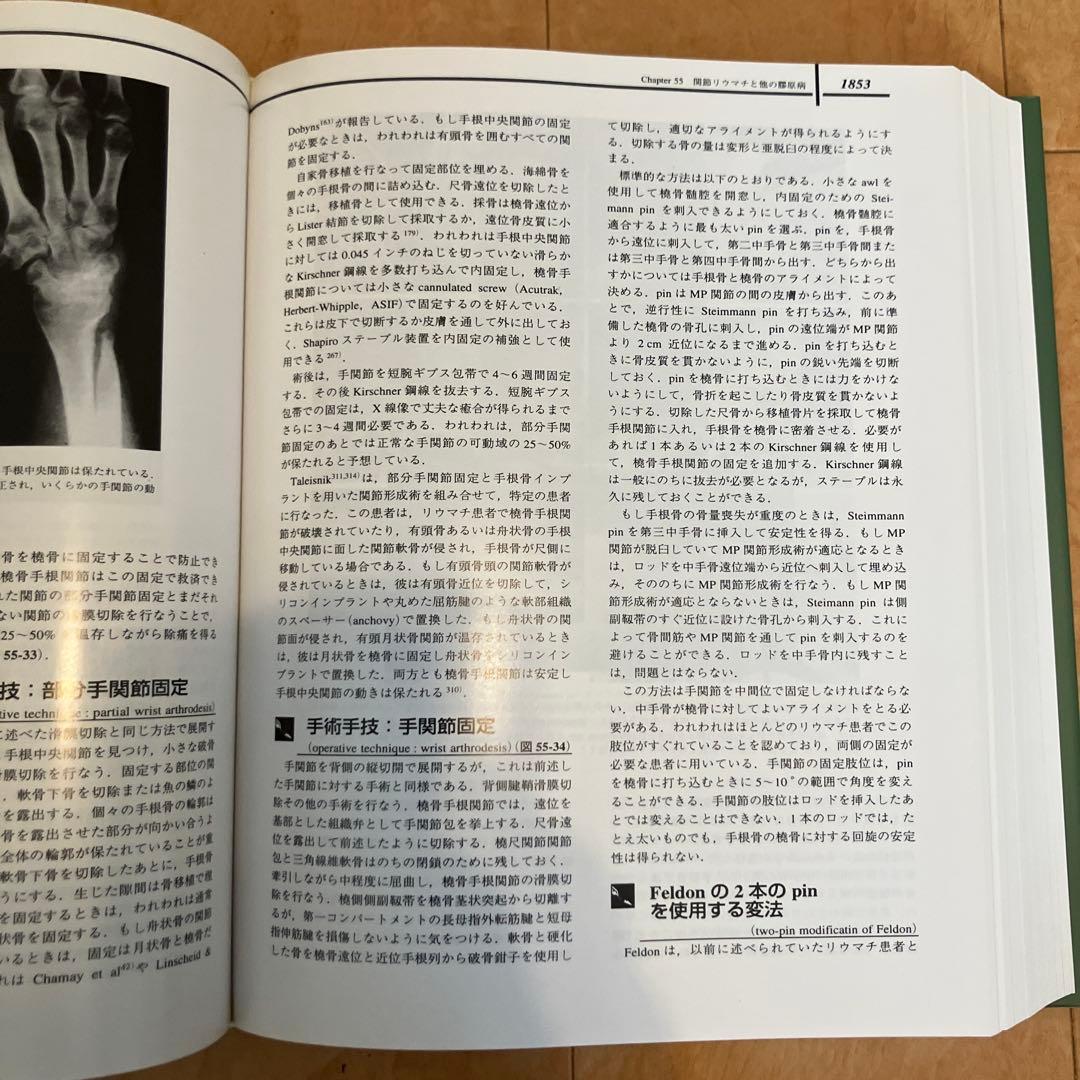 Greenの手の外科手術 日本語版　第4版 Vol. 1, 2
