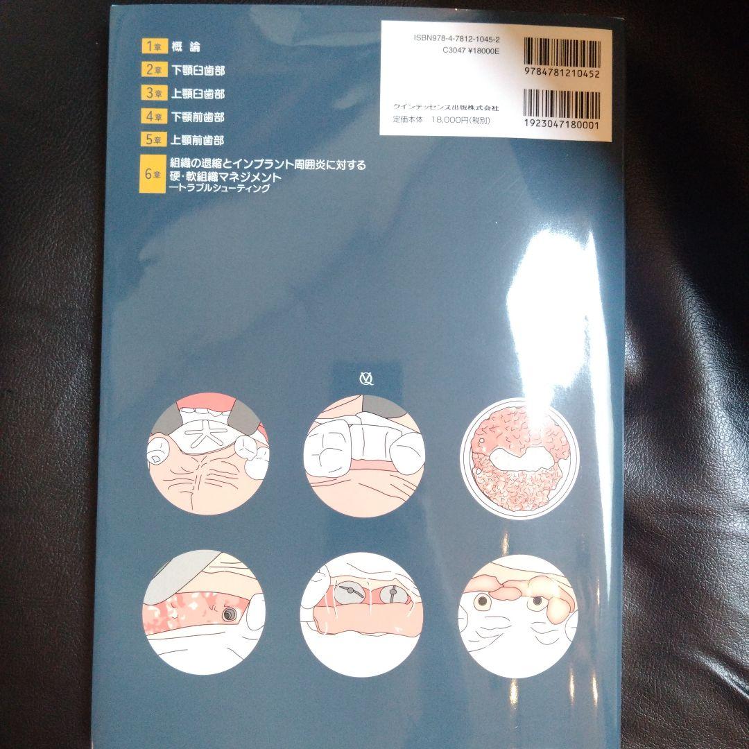硬・軟組織マネジメント大全 インプラント　歯科 クインテッセンス出版