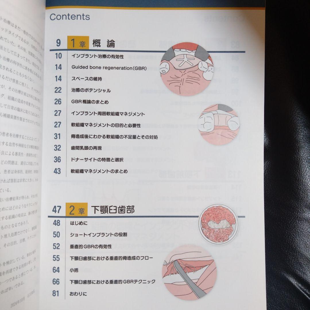 硬・軟組織マネジメント大全 インプラント　歯科 クインテッセンス出版