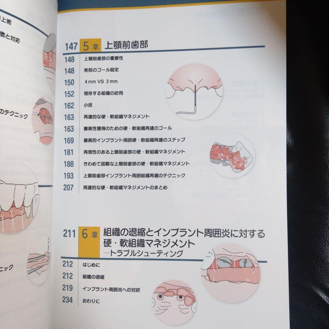 硬・軟組織マネジメント大全 インプラント　歯科 クインテッセンス出版