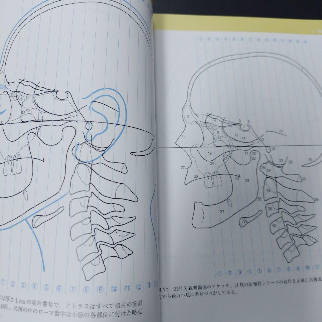 脳の機能解剖と画像診断