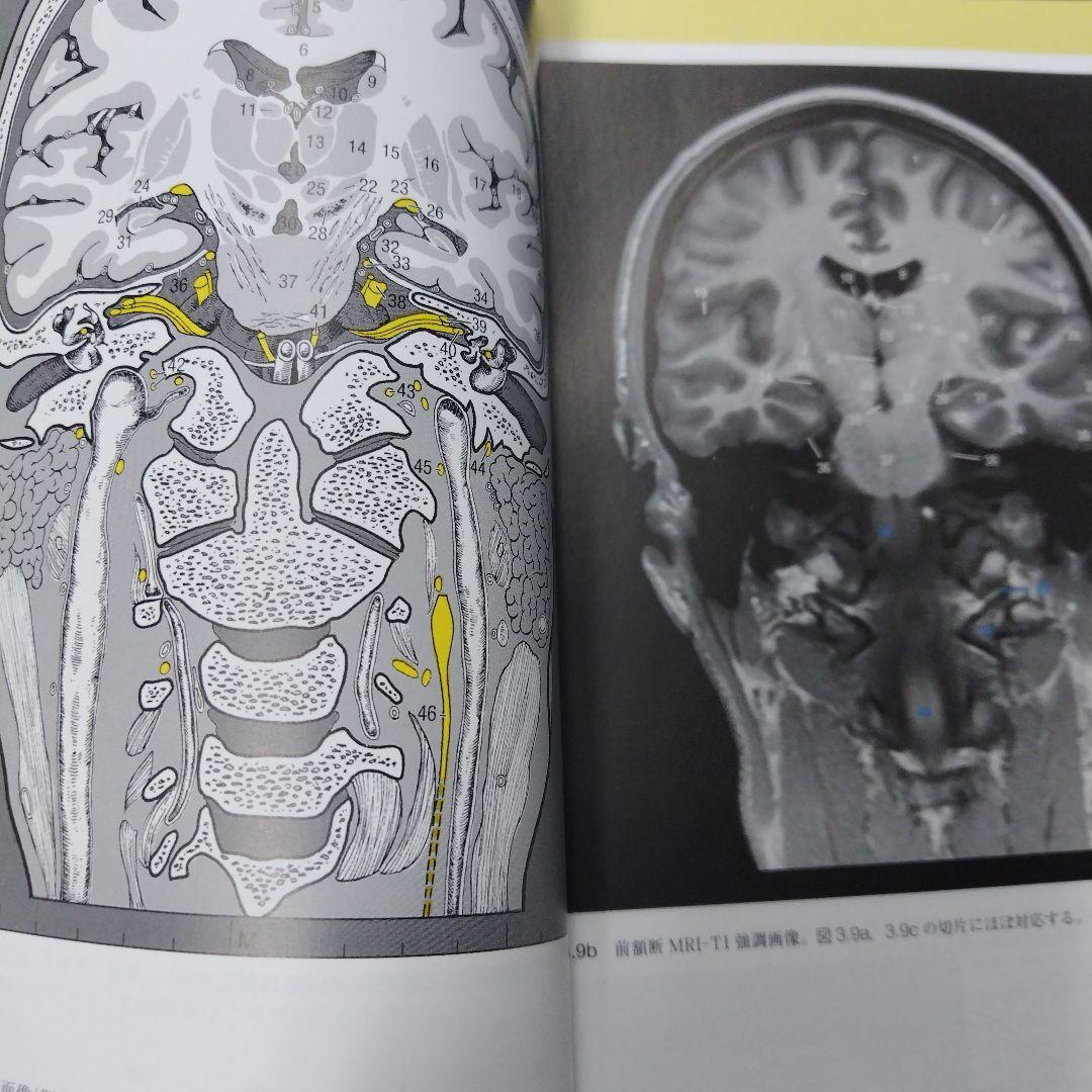 脳の機能解剖と画像診断