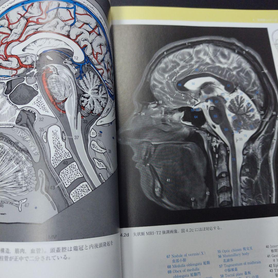 脳の機能解剖と画像診断