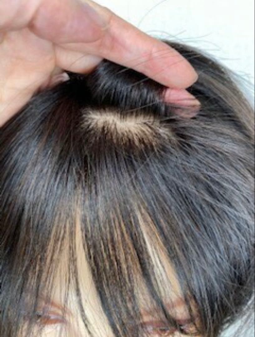 スーパーワイドヘアピース高級人毛100%リアル頭皮二重引き抜き総手植えヘアピース