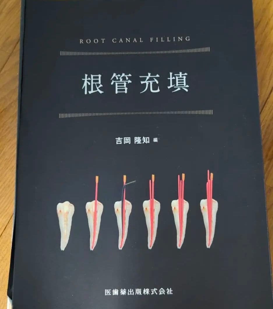 はじめての全部床義歯 根管洗浄 根管充塡 ペリオドンタルデブライドメント