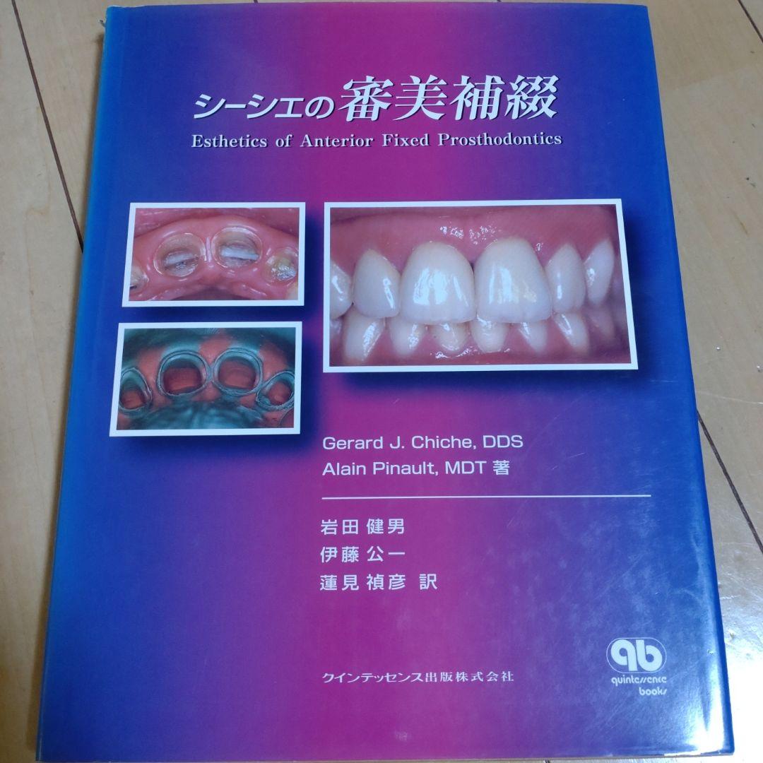 シーシェの審美補綴