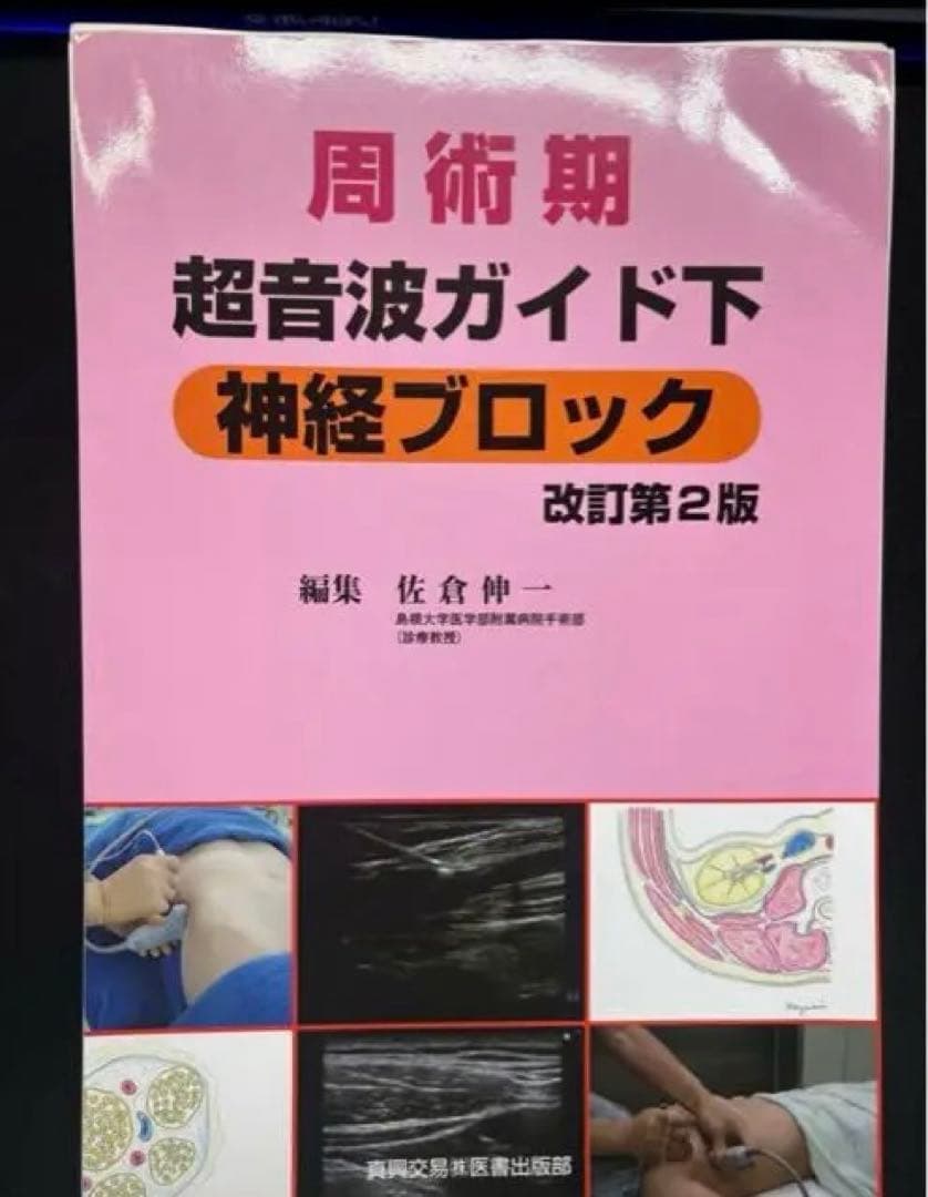 【裁断済】周術期超音波ガイド下神経ブロック