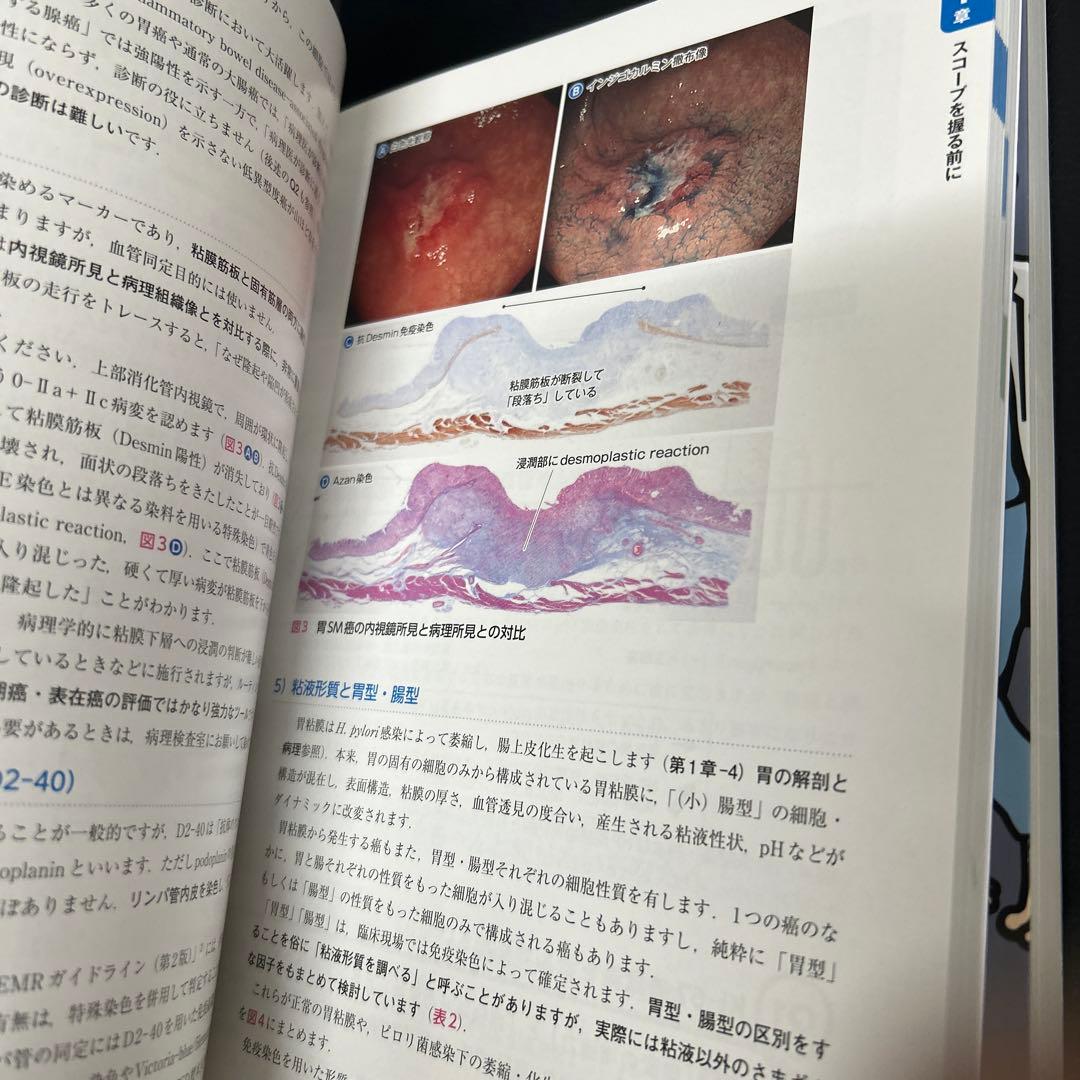 上部消化管内視鏡診断の基本とコツ 消化器内視オオハタ流の基本手 2冊セット