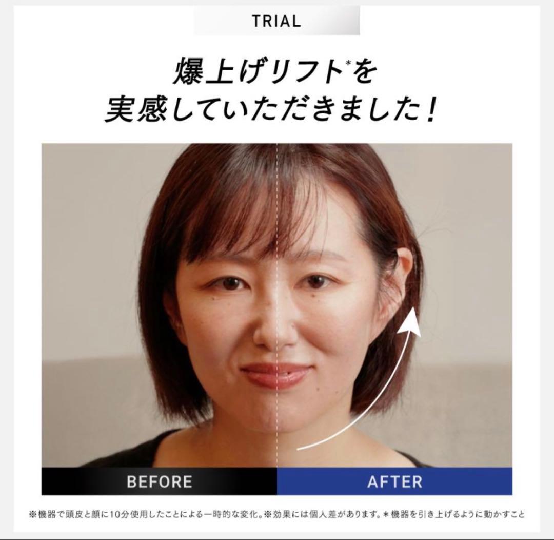 ☆新品未開封☆MYTREX PROVE CORE 美容器セット