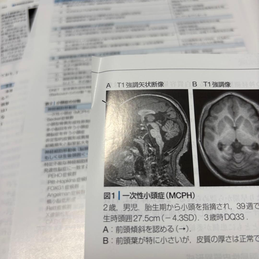 【裁断済み】小児神経の画像診断 改訂第2版
