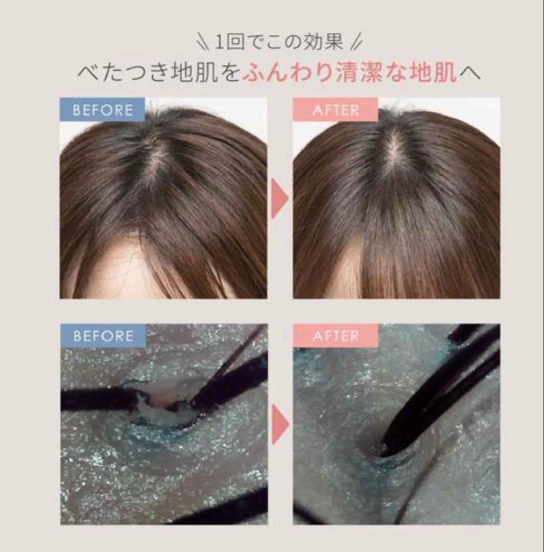 ミーゼ ニードルヘッドスパリフト