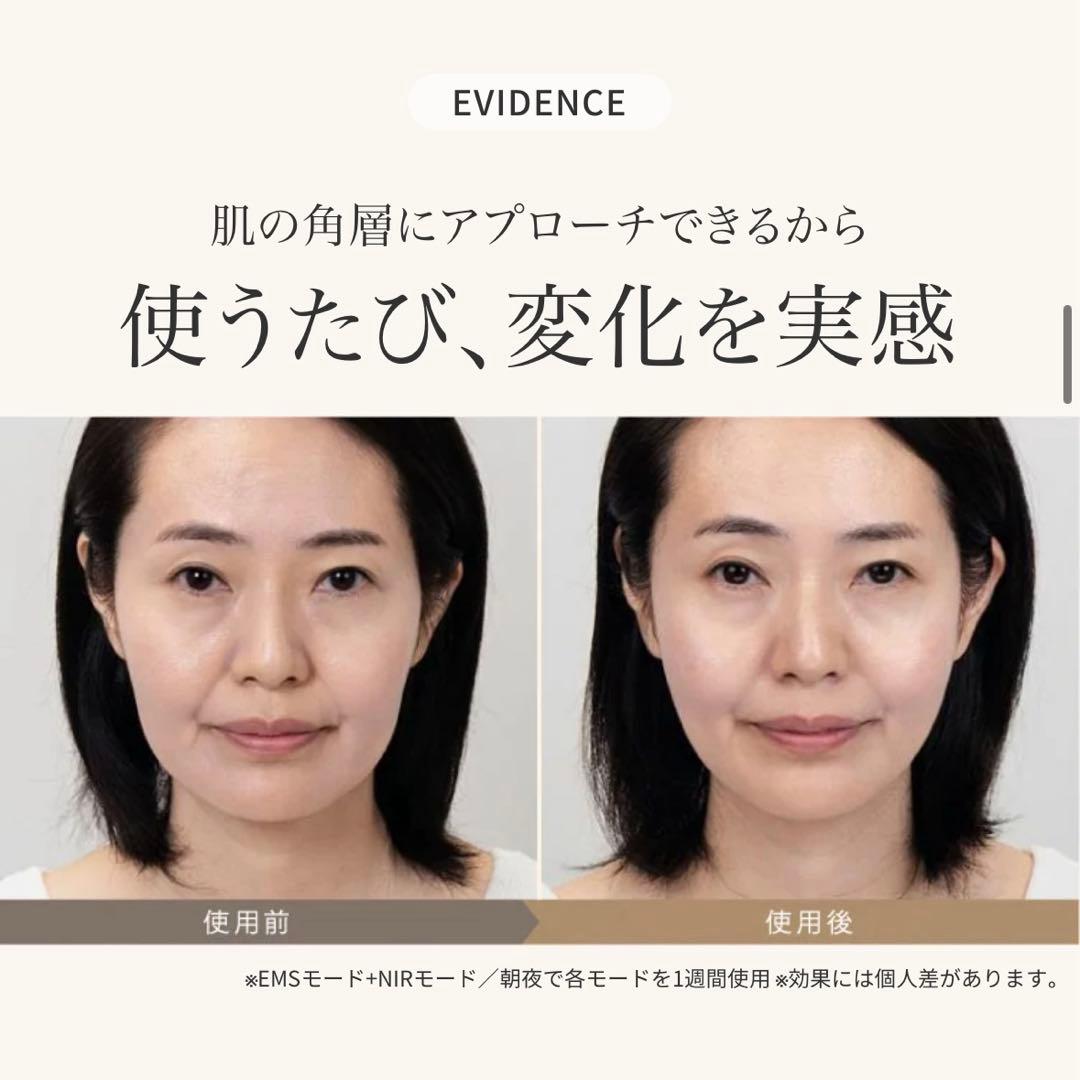 【新品】 MYTREX MiRAY ONE ブラック 黒 リフトアップ 美顔器