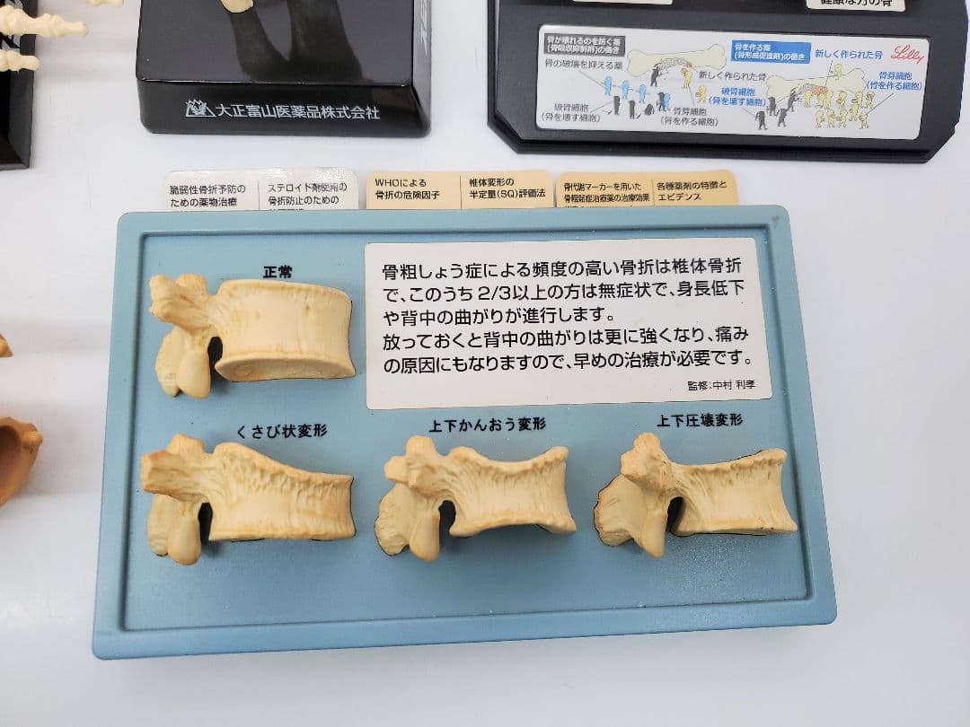 人体模型 セット 手　足　腰椎　脊髄　冠状動脈模型　骨　大正富山 旭化成ファーマ