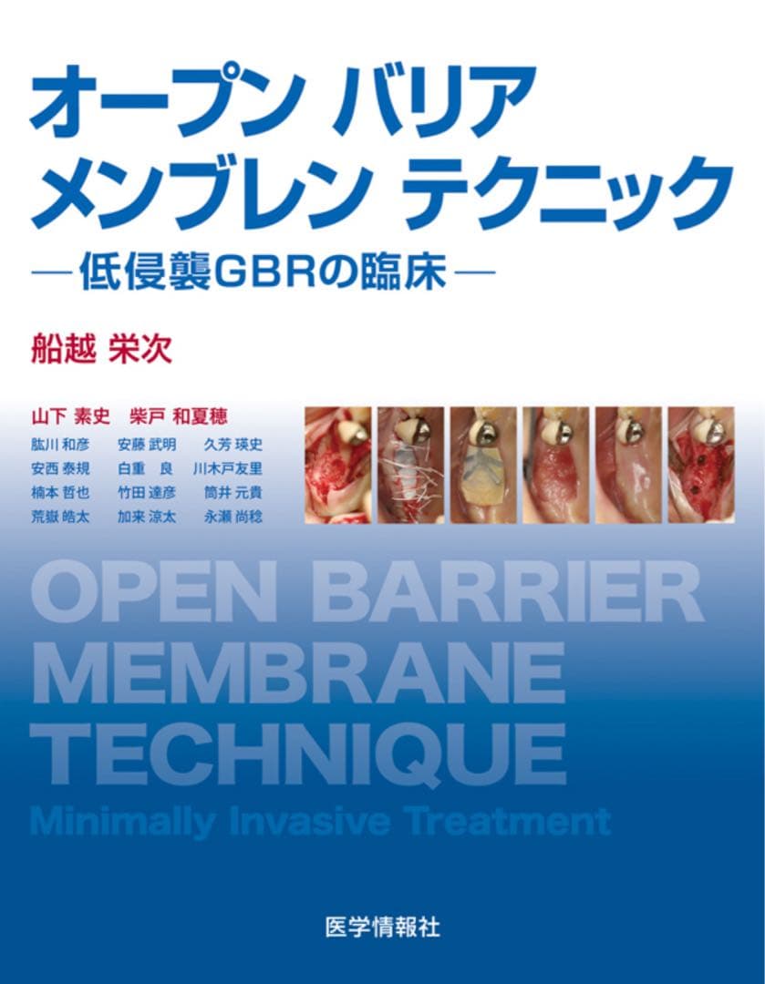 【裁断済み】オープンバリアメンブレンテクニック