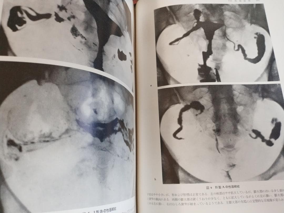 現代産科婦人科学大系〈8A〉女性性器の奇形 発育 位置異常 損傷 炎症1971年