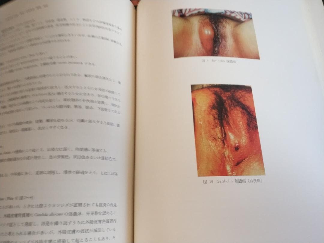 現代産科婦人科学大系〈8A〉女性性器の奇形 発育 位置異常 損傷 炎症1971年