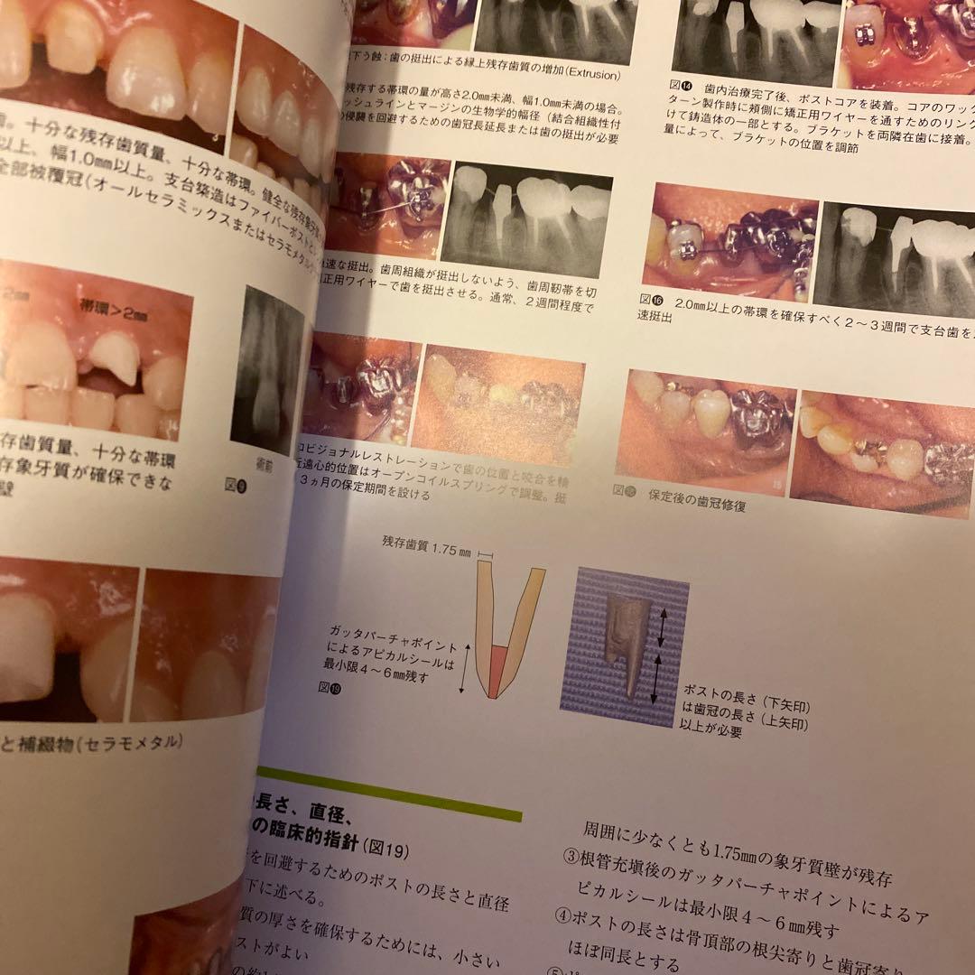 咬合・補綴の臨床マスター