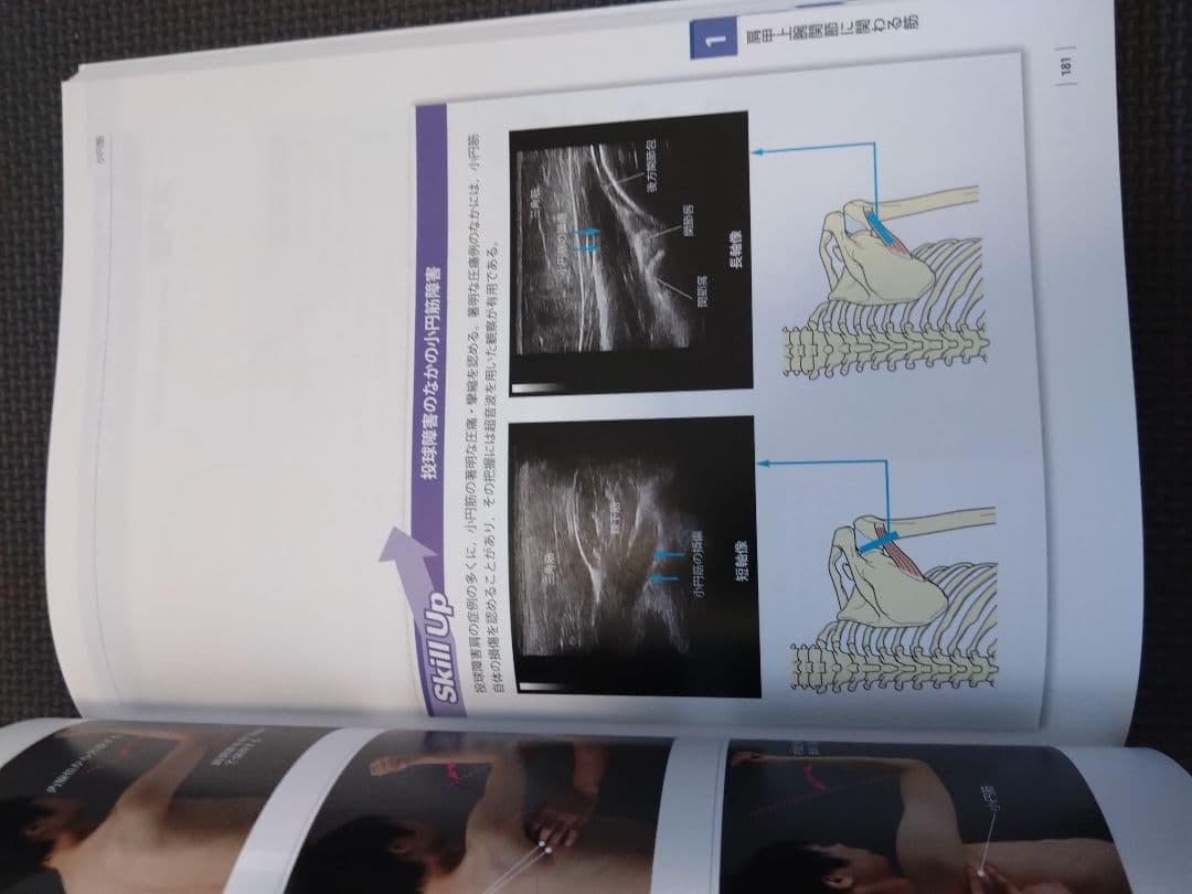 機能解剖学的触診技術 最新上下肢セット　理学療法士　作業療法　リハビリ　まとめ売