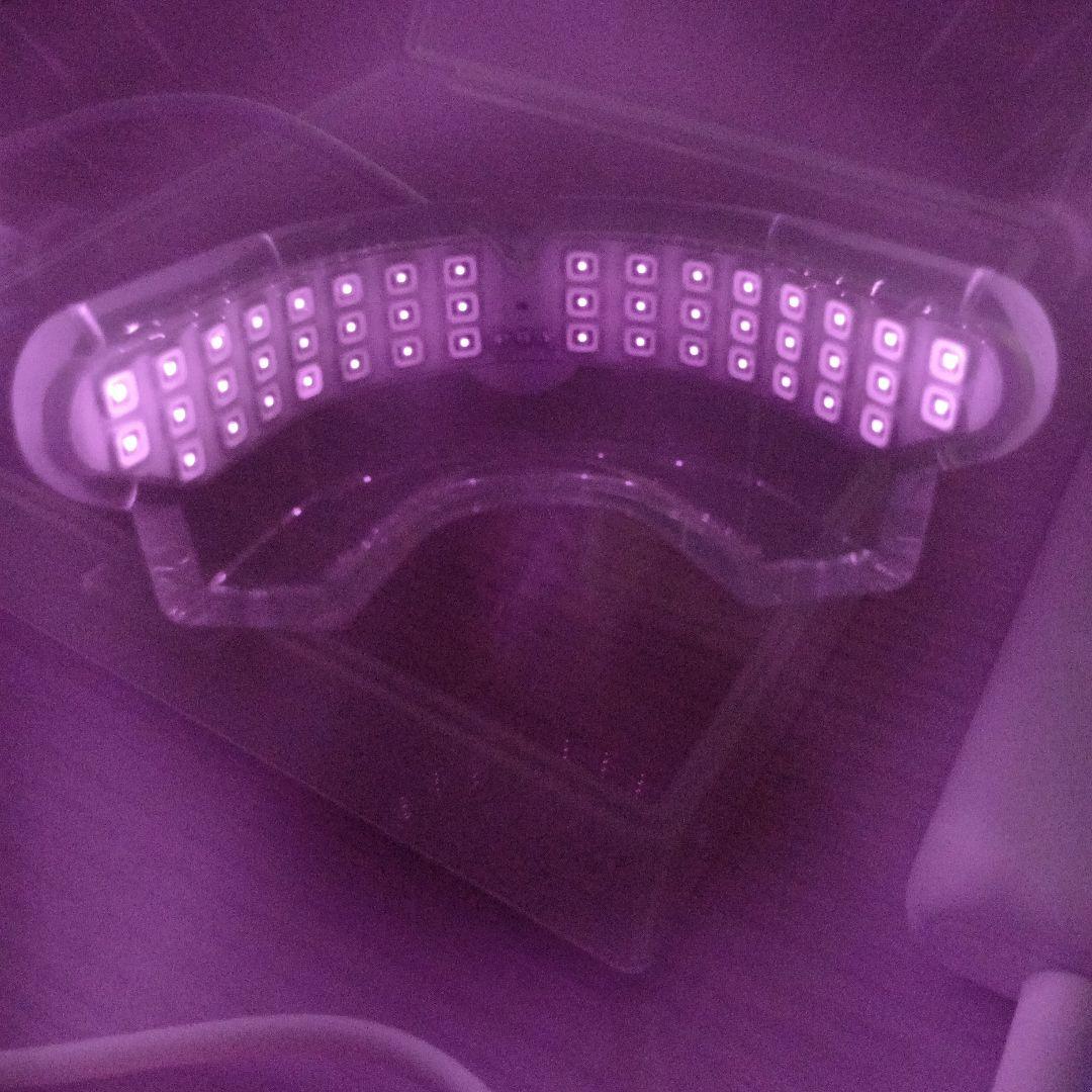 インビザラインpbmヒーリング