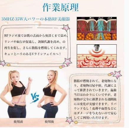 キャビテーション