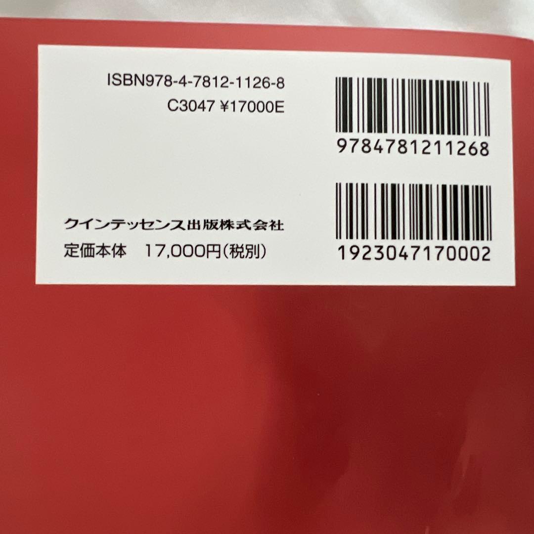 アライナー矯正 治療戦略
