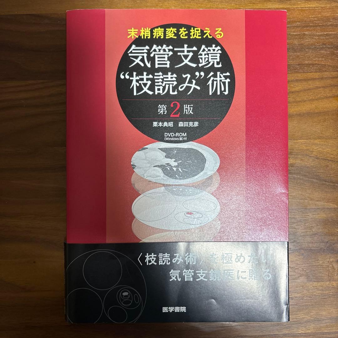 末梢病変を捉える気管支鏡\