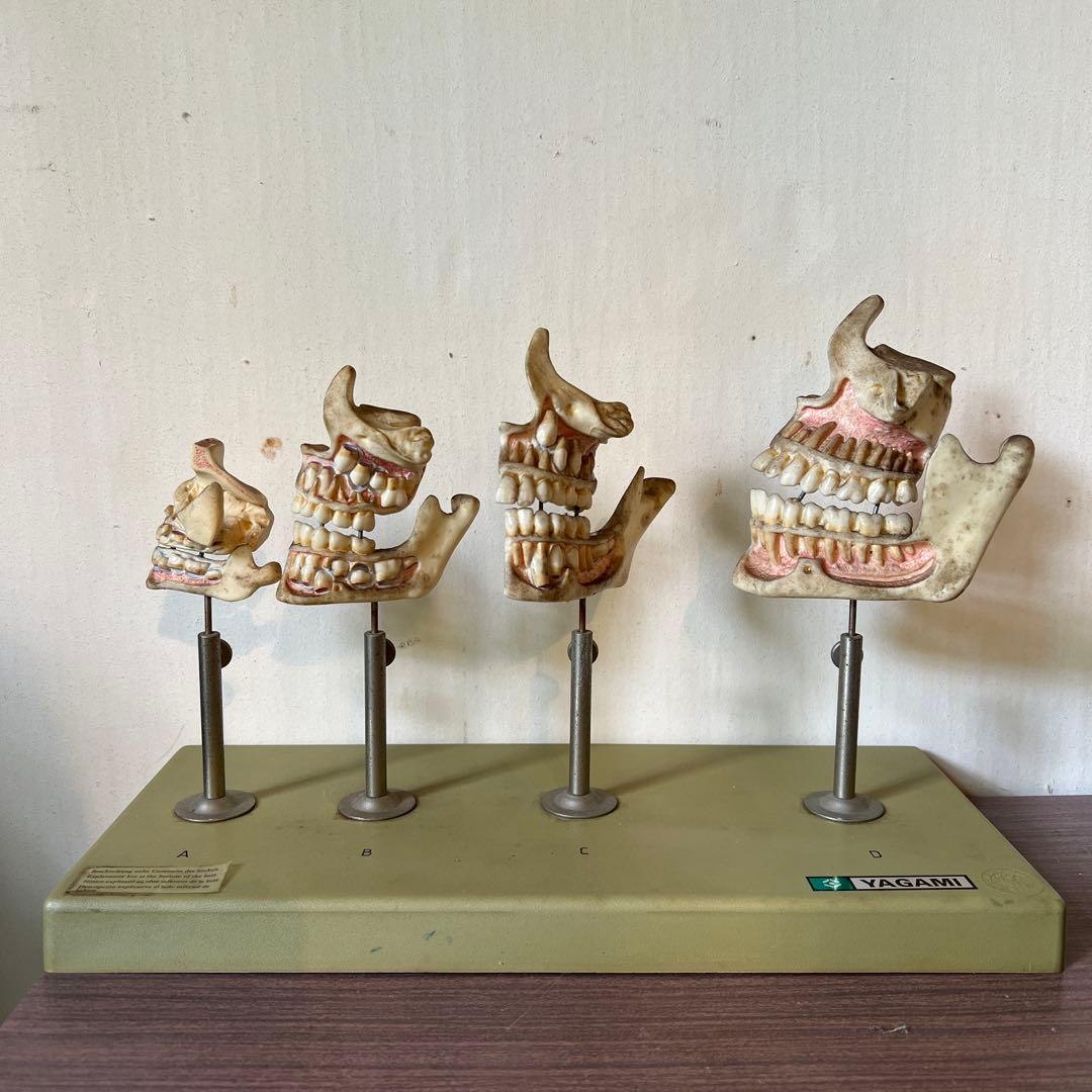 歯のモデル　発育模型