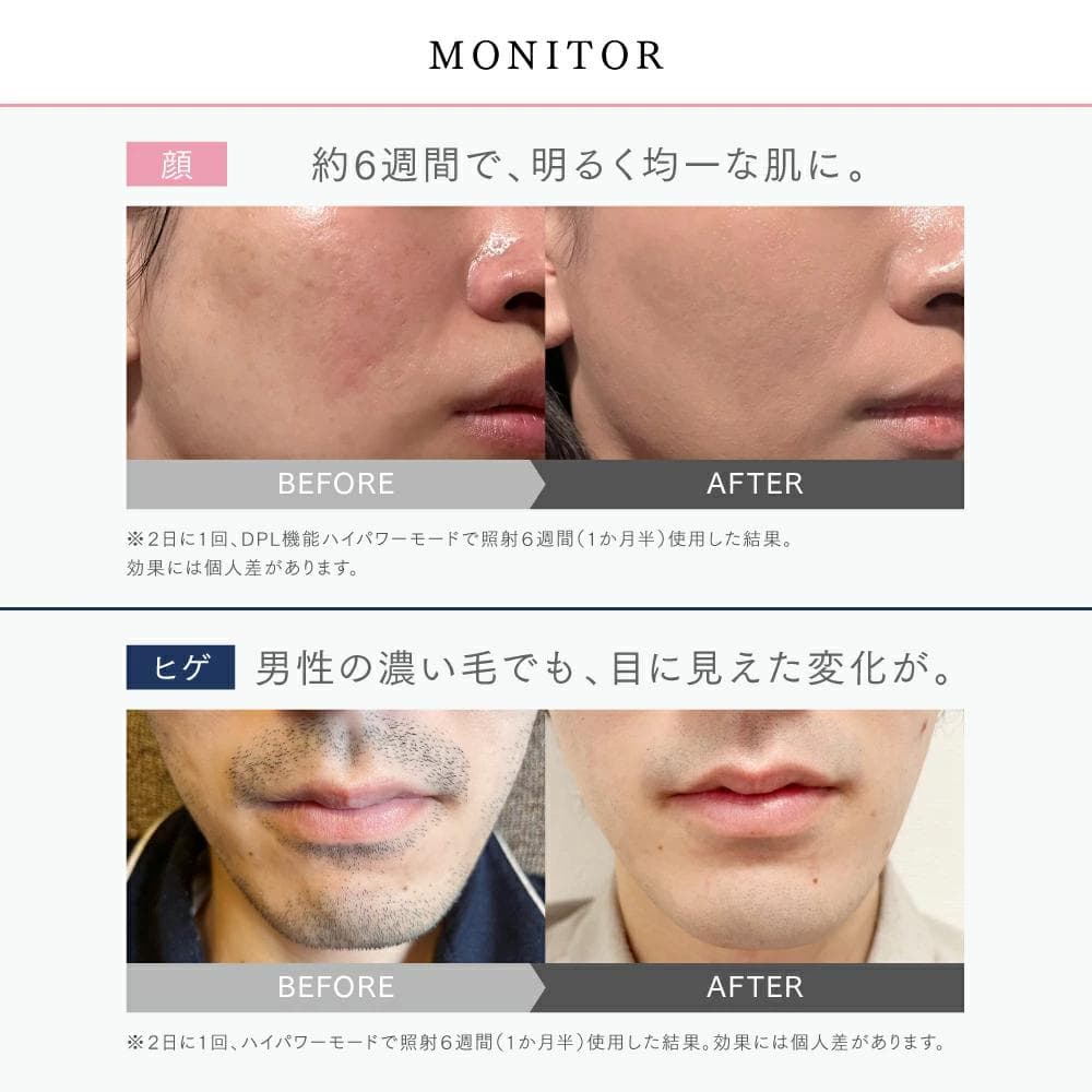 保証期間内　脱毛器 MYTREX MiRAY　MT-MR22B