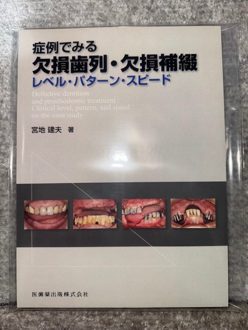【裁断済み】症例でみる欠損歯列・欠損補綴　レベル・パターン・スピード