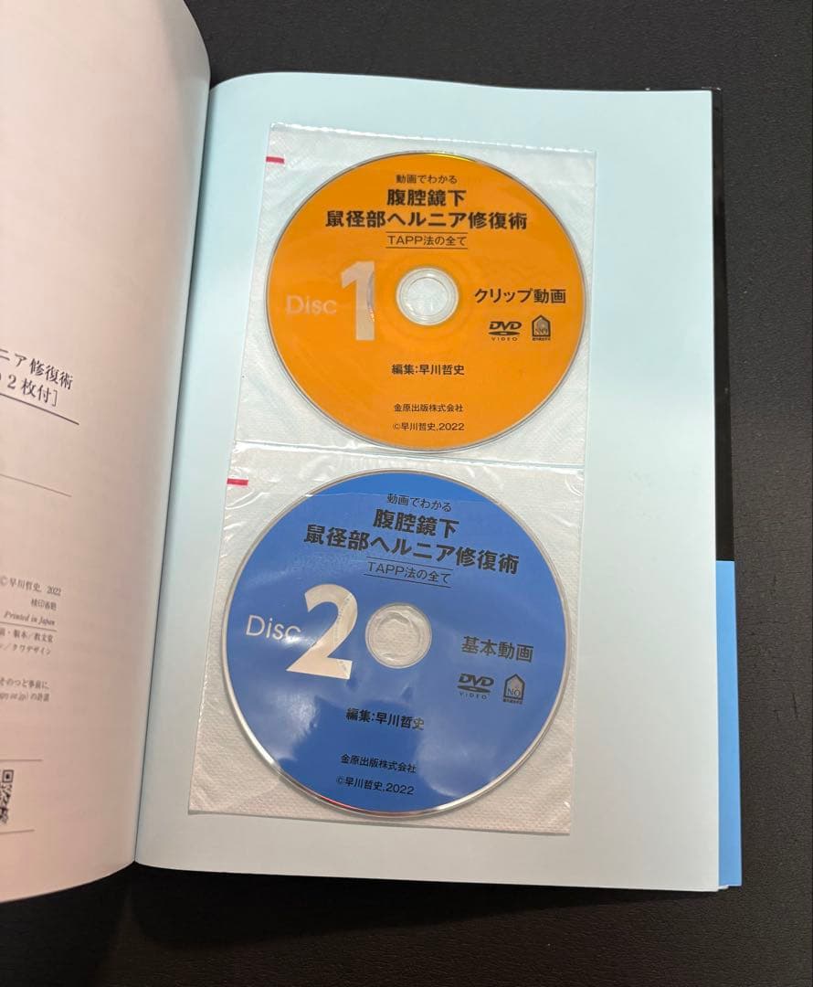腹腔鏡下鼠径部ヘルニア修復術 TAPP法のすべて