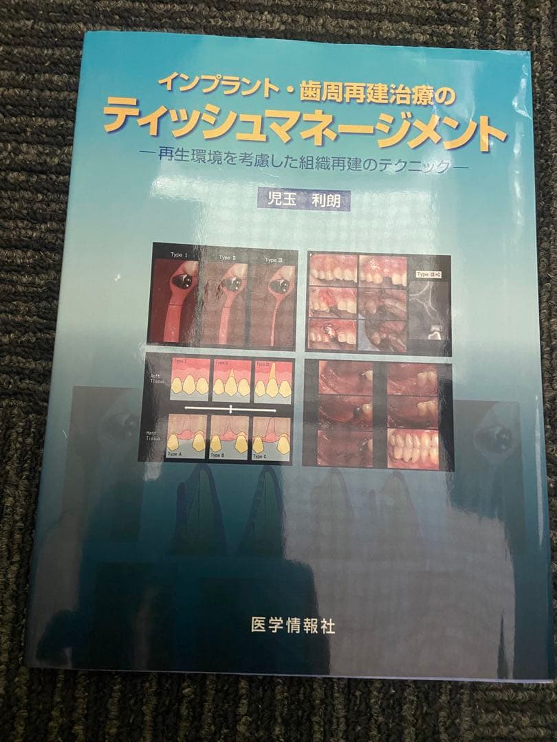 インプラント・歯周再建治療のティッシュマネージメント